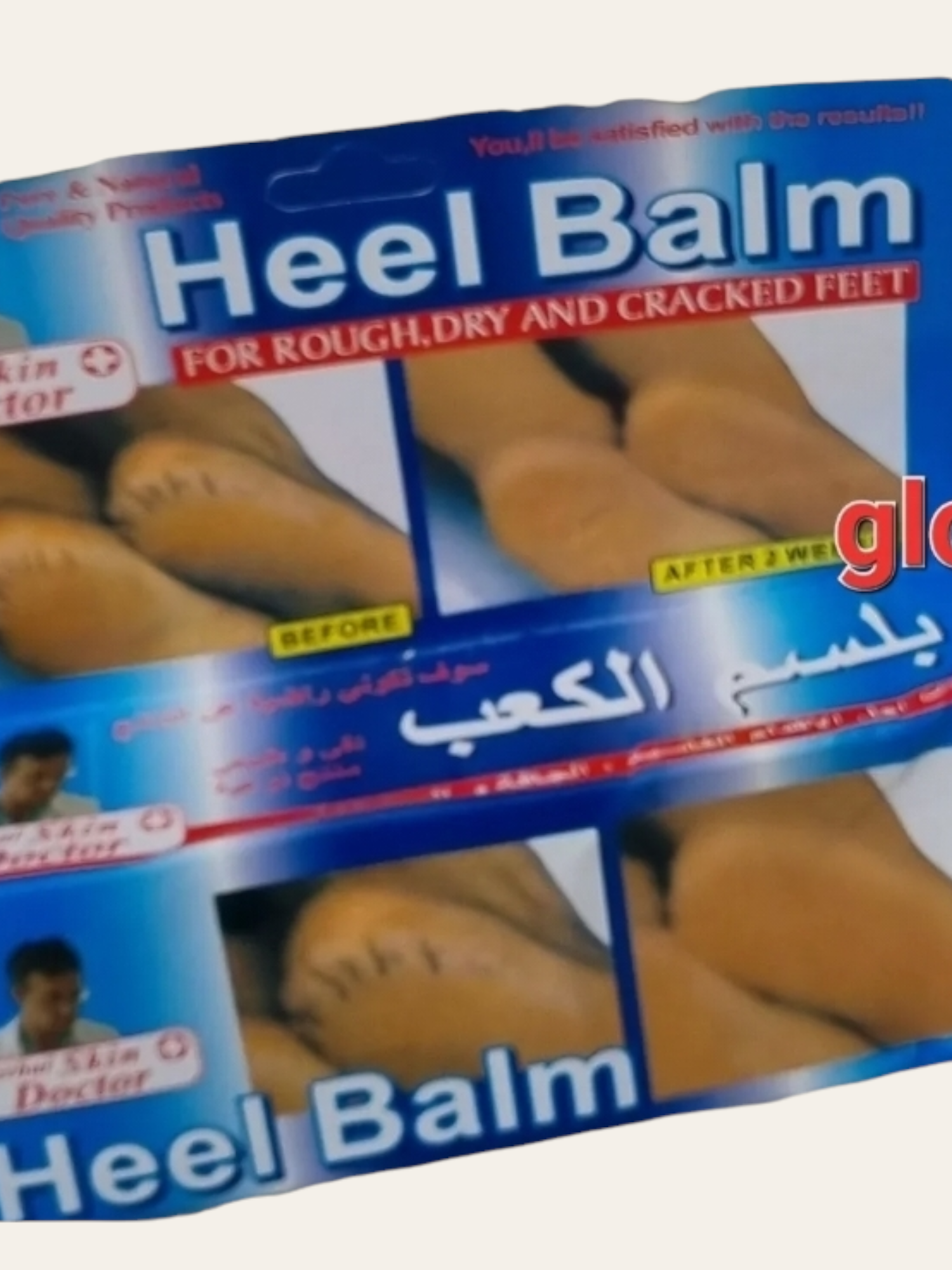 SKIN DOCTOR CRACKED HEEL BALM REPAIR CREAM DRY SKIN RESCUE FEET MOISTURISER