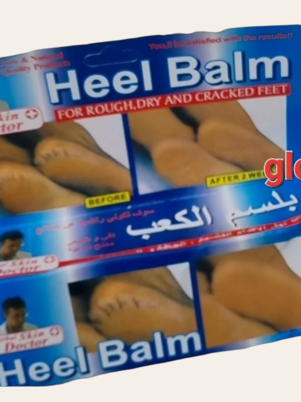 SKIN DOCTOR CRACKED HEEL BALM REPAIR CREAM DRY SKIN RESCUE FEET MOISTURISER